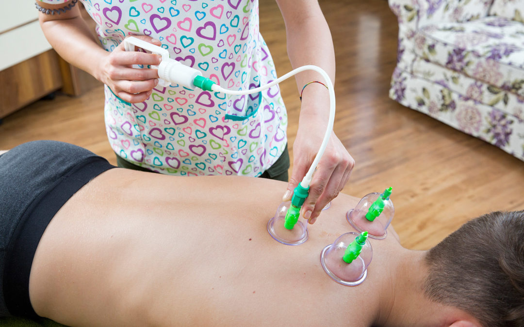 Cupping terapie